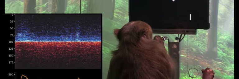 EL NUEVO AVANCE DE ELON MUSK CON NEURALINK