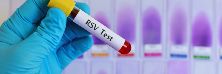 Virus sincicial: lo que debes saber
